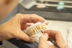 Намерете най-добрите оферти за Dental Implants 15